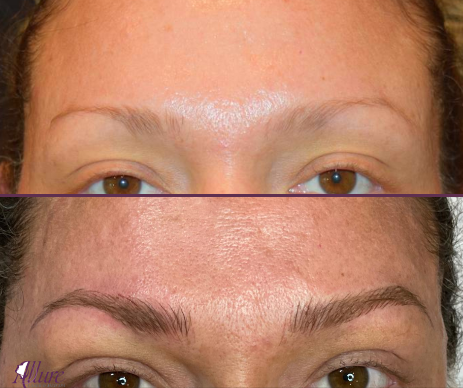 To Crystal Clear (Replacement) -  Microblading